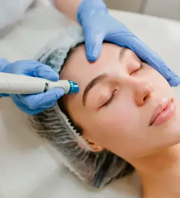 Mesoterapia Facial en Benalmádena